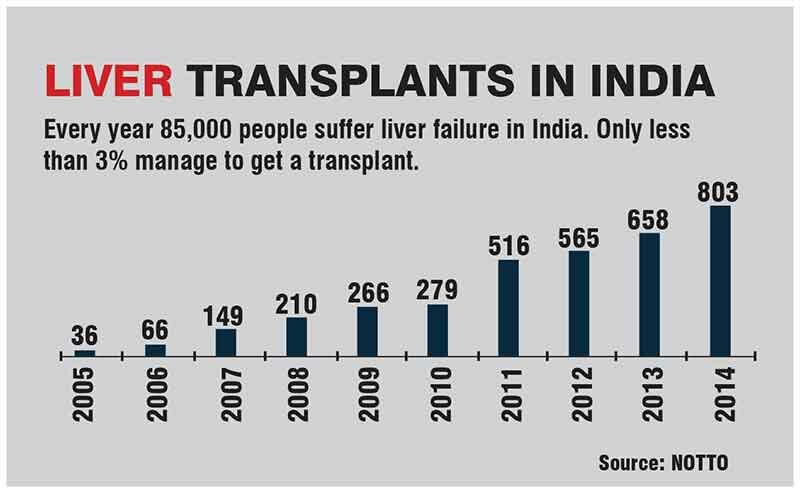 Acute shortage of liver transplants
